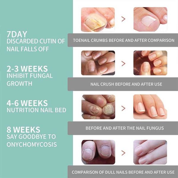 South Moon Nail Care Pen